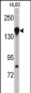 NUP155 Antibody (N-term)